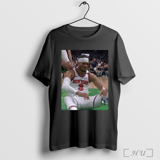 Photos Of Josh Hart After Getting Elbowed In The Face New York Knicks T Shirts Sweatshirt